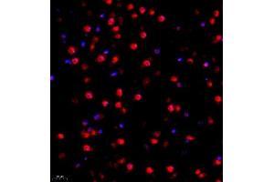 Immunofluorescence of paraffin embedded mouse brain using FUS (ABIN7075919) at dilution of 1:1000 (400x lens) (TLS/FUS anticorps)