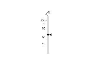 Western blot analysis in Y79 cell line lysates (35ug/lane). (SIX3 anticorps  (AA 138-166))