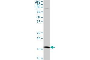 CMTM5 MaxPab polyclonal antibody. (CMTM5 anticorps  (AA 1-156))