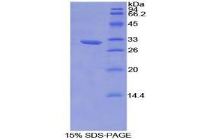 SDS-PAGE (SDS) image for Hydroxyacid Oxidase (Glycolate Oxidase) 1 (HAO1) (AA 102-357) protein (His tag) (ABIN1877687) (HAO1 Protein (AA 102-357) (His tag))