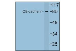 Image no. 1 for anti-Cadherin 11 (CDH11) antibody (ABIN317681) (OB Cadherin anticorps)