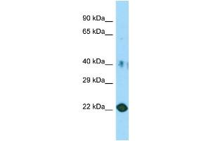Host: Rabbit Target Name: C11orf34 Sample Type: HT1080 Whole Cell lysates Antibody Dilution: 1. (Plet1 anticorps  (Middle Region))