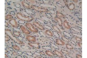 IHC-P analysis of Human Kidney Tissue, with DAB staining. (GAL3ST1 anticorps  (AA 57-196))