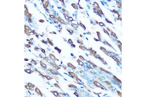 Immunohistochemistry of paraffin-embedded mouse stomach using DMT1 Rabbit pAb (ABIN6129471, ABIN6147839, ABIN6147840 and ABIN6214400) at dilution of 1:100 (40x lens). (SLC11A2 anticorps  (AA 1-100))