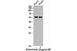 Western Blot analysis of HepG2 cells using Phospho-XIAP (S87) Polyclonal Antibody (XIAP anticorps  (pSer87))