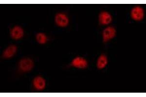 ABIN6266718 staining Hela by IF/ICC. (ZIC1/2/3 anticorps)