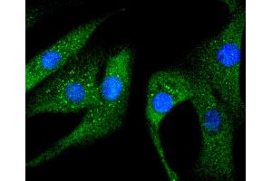 NIH/3T3 cells were stained with Hsp27(S78) (5E1 ) Monoclonal Antibody  at [1:200] incubated overnight at 4C, followed by secondary antibody incubation, DAPI staining of the nuclei and detection. (HSP27 anticorps  (pSer78))