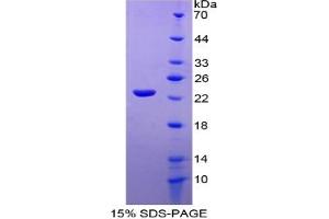 SDS-PAGE (SDS) image for Interleukin 10 (IL10) ELISA Kit (ABIN6574130)