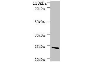 Western blot All lanes: deoD antibody at 2 μg/mL + DH5a whole cell lysate Secondary Goat polyclonal to rabbit IgG at 1/10000 dilution Predicted band size: 26 kDa Observed band size: 26 kDa (DeoD (AA 2-239) anticorps)