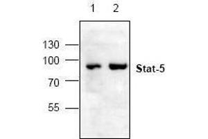 Image no. 1 for anti-Signal Transducer and Activator of Transcription 5A (STAT5A) antibody (ABIN127149) (STAT5A anticorps)