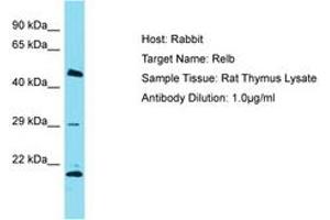 Image no. 1 for anti-V-Rel Reticuloendotheliosis Viral Oncogene Homolog B (RELB) (AA 380-429) antibody (ABIN6750252) (RELB anticorps  (AA 380-429))