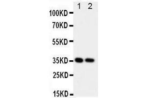 Western Blotting (WB) image for anti-CD68 Molecule (CD68) (AA 312-326), (Middle Region) antibody (ABIN3044428)