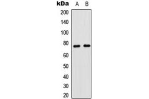 Western blot analysis of CD180 expression in human spleen (A), mouse brain (B) whole cell lysates. (CD180 anticorps  (Center))