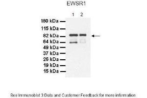 Lanes:   1. (EWSR1 anticorps  (Middle Region))