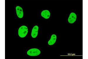 Immunofluorescence of monoclonal antibody to SMAD3 on HeLa cell. (SMAD3 anticorps  (AA 147-270))