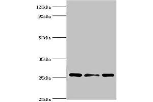 Western blot All lanes: Chloride intracellular channel protein 1 antibody at 4 μg/mL Lane 1: Hela whole cell lysate Lane 2: Jurkat whole cell lysate Lane 3: MCF-7 whole cell lysate Secondary Goat polyclonal to rabbit IgG at 1/10000 dilution Predicted band size: 27 kDa Observed band size: 27 kDa (CLIC1 anticorps  (AA 42-241))