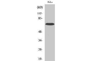 Western Blotting (WB) image for anti-Interleukin 17 Receptor C (IL17RC) (C-Term) antibody (ABIN3175627) (IL17RC anticorps  (C-Term))