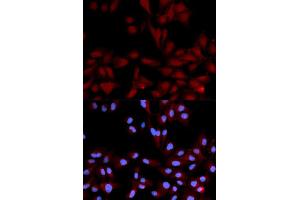 Immunofluorescence (IF) image for anti-Mitogen-Activated Protein Kinase 14 (MAPK14) (pTyr182) antibody (ABIN1870378) (MAPK14 anticorps  (pTyr182))