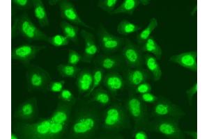 Immunofluorescence analysis of A549 cells using LIG1 antibody. (LIG1 anticorps)