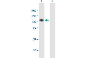 Western Blot analysis of ENPP2 expression in transfected 293T cell line by ENPP2 MaxPab polyclonal antibody. (ENPP2 anticorps  (AA 1-863))