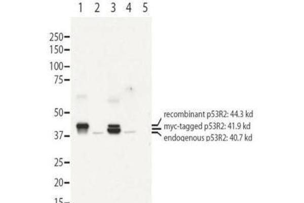 RRM2B anticorps  (N-Term)