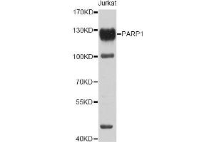 Western blot analysis of extracts of Jurkat cells, using PARP1 antibody (ABIN5995673) at 1/1000 dilution. (PARP1 anticorps)