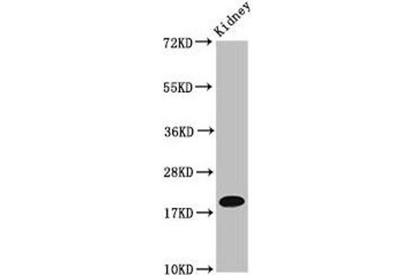 NAA38 anticorps  (AA 2-173)