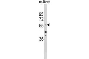 Western blot analysis of HNF1A Antibody (Center) in mouse liver tissue lysates (35ug/lane). (HNF1A anticorps  (Middle Region))