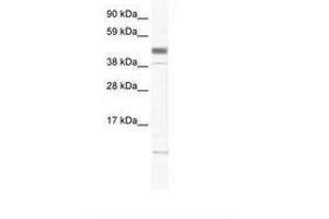 Image no. 1 for anti-Zinc Finger, Matrin-Type 1 (ZMAT1) (AA 359-408) antibody (ABIN6736003) (ZMAT1 anticorps  (AA 359-408))