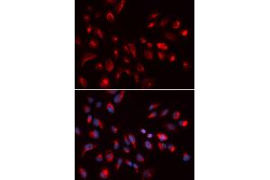 Immunofluorescence analysis of U2OS cells using CHRM5 antibody (ABIN5973103). (CHRM5 anticorps)