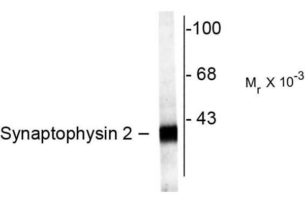 Synaptoporin anticorps  (C-Term)