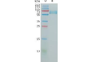 Human CD147 Protein, hFc Tag on SDS-PAGE under reducing condition. (CD147 Protein (AA 140-323) (Fc Tag))