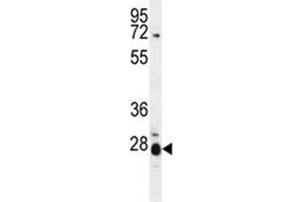 IL17B anticorps  (AA 39-66)