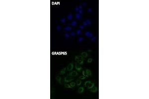 Immunofluorescence (IF) image for Donkey anti-Rabbit IgG antibody (FITC) (ABIN2667148) (Âne anti-Lapin IgG Anticorps (FITC))