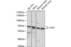 Western blot analysis of extracts of various cell lines, using CLK2 antibody (ABIN6130086, ABIN6138733, ABIN6138734 and ABIN6223869) at 1:1000 dilution. (CLK2 anticorps  (AA 239-498))