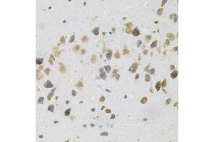 Immunohistochemistry of paraffin-embedded mouse brain using FLT3 antibody. (FLT3 anticorps)