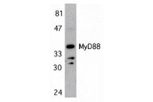 Western Blotting (WB) image for anti-Myeloid Differentiation Primary Response Gene (88) (MYD88) (Middle Region) antibody (ABIN1031006) (MYD88 anticorps  (Middle Region))