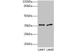 Western blot All lanes: Plaur antibody at 2 μg/mL Lane 1: 293T whole cell lysate Lane 2: Rat brain tissue Secondary Goat polyclonal to rabbit IgG at 1/10000 dilution Predicted band size: 36, 25 kDa Observed band size: 36 kDa (PLAUR anticorps  (AA 25-299))