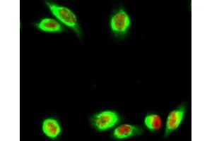 Immunofluorescence analysis of Hela cell. (Ki-67 anticorps)
