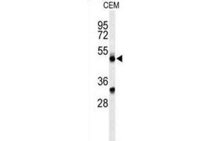 Western Blotting (WB) image for anti-Complement Factor P (CFP) antibody (ABIN3004386) (CFP anticorps)