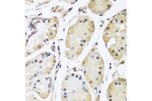 Immunohistochemistry of paraffin-embedded human stomach using HNRNPL antibody (ABIN5974591) at dilution of 1/100 (40x lens). (HNRNPL anticorps)