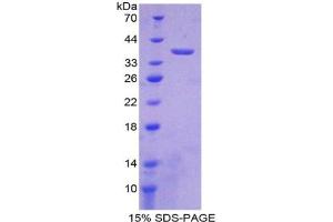 SDS-PAGE analysis of Mouse LDHB Protein. (LDHB Protéine)