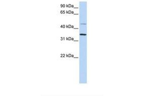 CLN6 anticorps  (C-Term)