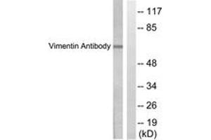 Western Blotting (WB) image for anti-Vimentin (VIM) (AA 411-460) antibody (ABIN2889287) (Vimentin anticorps  (AA 411-460))