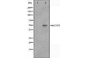 Western blot analysis on Jurkat cell lysate using ZIC1/2/3 Antibody,The lane on the left is treated with the antigen-specific peptide. (ZIC1/2/3 anticorps)