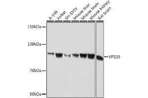 Western blot analysis of extracts of various cell lines, using VPS35 Rabbit mAb (ABIN7271276) at 1:1000 dilution. (VPS35 anticorps)