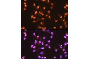 Immunofluorescence analysis of U-2 OS cells using PUMA Rabbit mAb (ABIN1678790, ABIN3018050, ABIN3018051 and ABIN7101572) at dilution of 1:100 (40x lens). (PUMA anticorps)