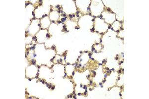 Immunohistochemistry of paraffin-embedded mouse lung using NFKB1 antibody at dilution of 1:200 (400x lens). (NFKB1 anticorps)