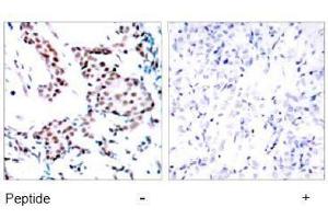 Image no. 1 for anti-Jun Proto-Oncogene (JUN) (Tyr170) antibody (ABIN197133) (C-JUN anticorps  (Tyr170))