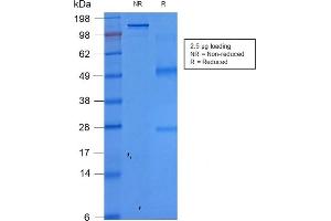 SDS-PAGE (SDS) image for anti-Epithelial Cell Adhesion Molecule (EPCAM) (AA 77-202), (Extracellular Domain) antibody (ABIN6939985)